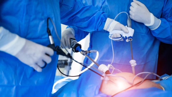 Laparoscopic Surgery in Chennai