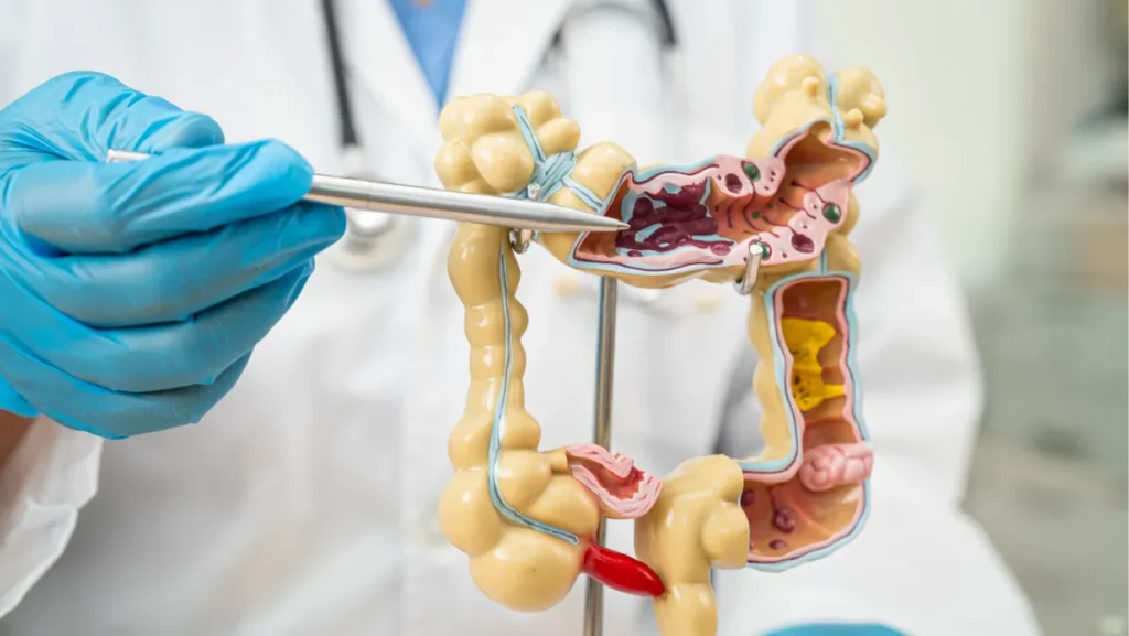 Appendix Treatment in Chennai