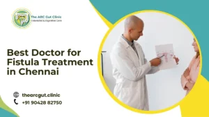 Best Doctor for Fistula Treatment in Chennai