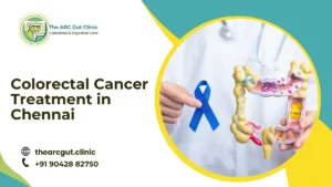 Colorectal Cancer Treatment in Chennai