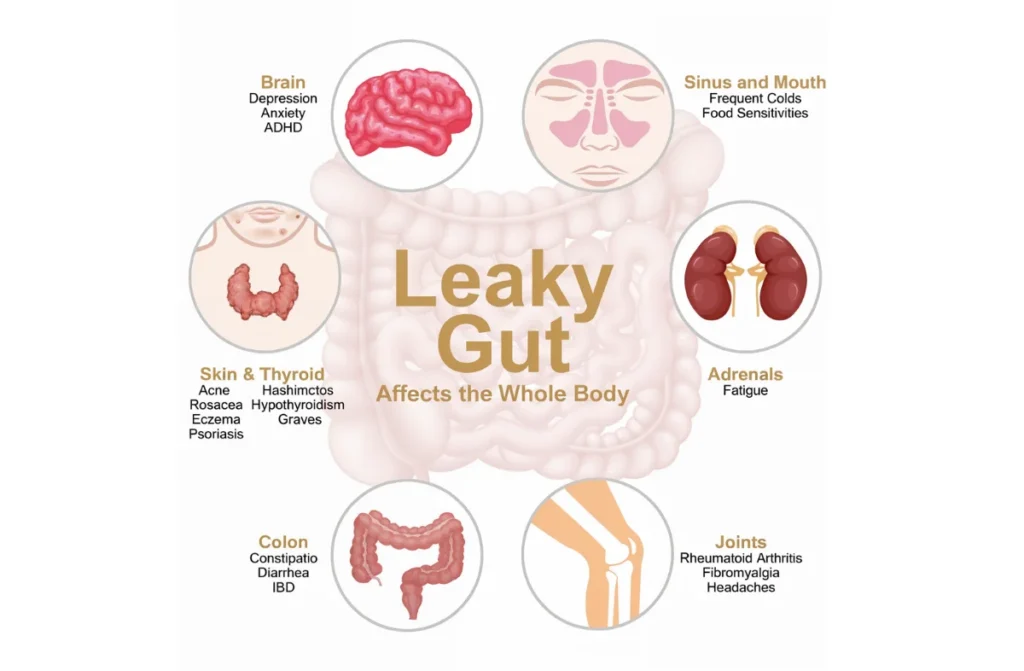 Gut Health Check