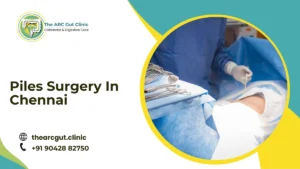 Piles Surgery In Chennai