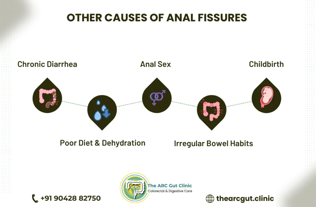 can anal fissures itch 