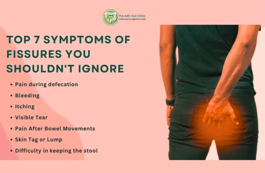 Can Anal Fissures Itch