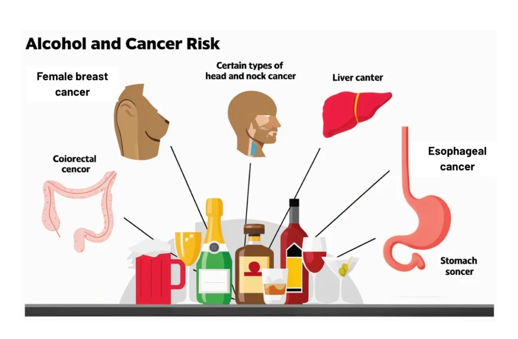 Colorectal Cancer and Alcohol Use