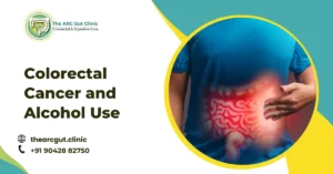 Colorectal Cancer and Alcohol Use