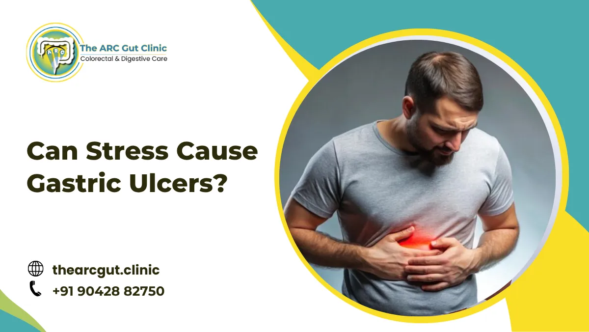 Can Stress Cause Gastric Ulcers?