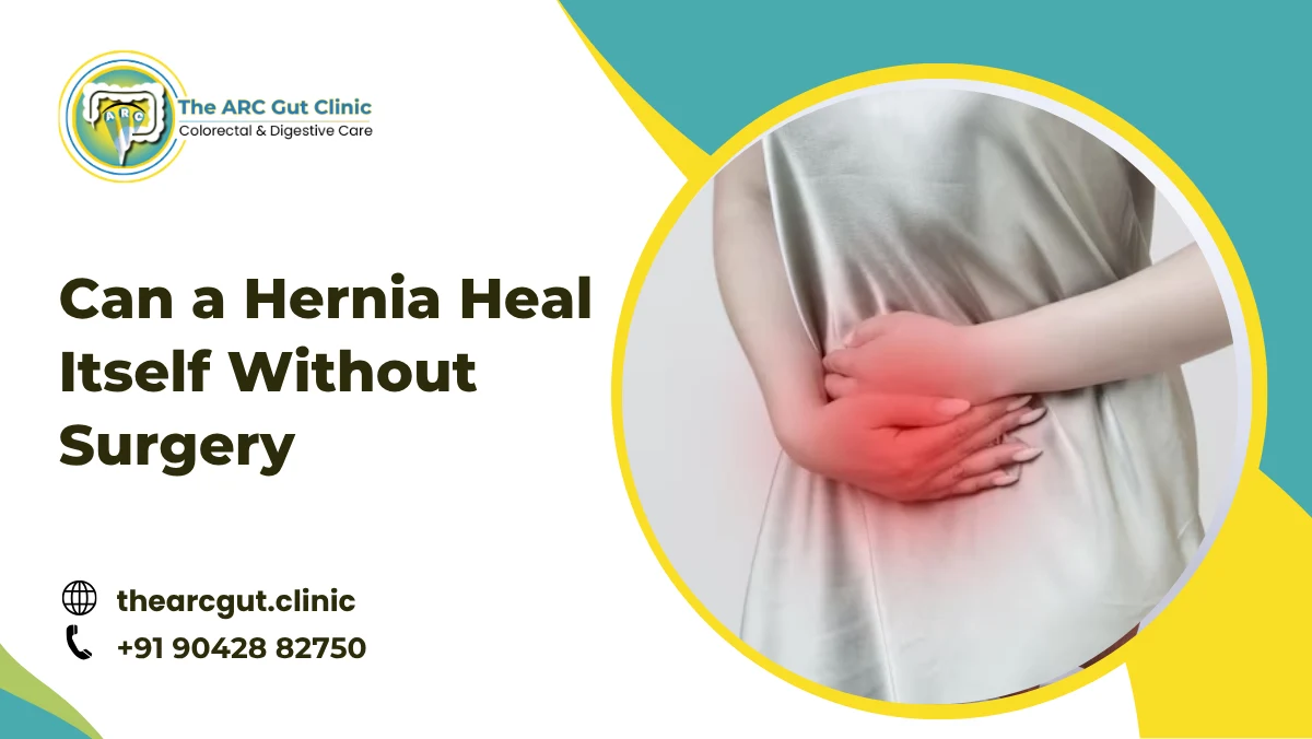 Can a Hernia Heal Itself Without Surgery