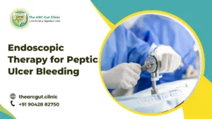 Endoscopic Therapy for Peptic Ulcer Bleeding