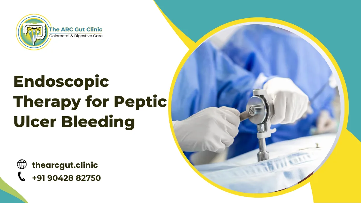 Endoscopic Therapy for Peptic Ulcer Bleeding