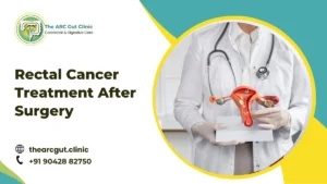 Rectal Cancer Treatment After Surgery
