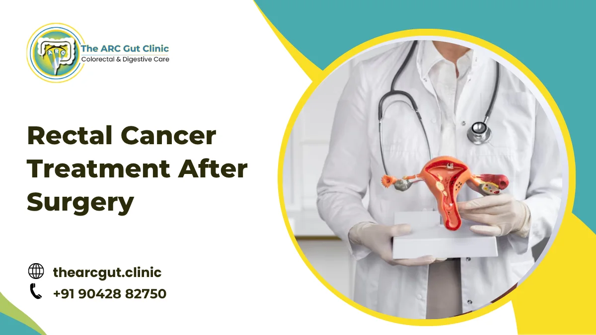 Rectal Cancer Treatment After Surgery