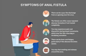 Best Doctor for Fistula Treatment in Chennai