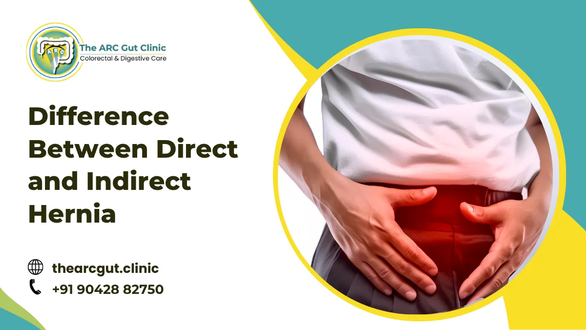 Difference Between Direct and Indirect Hernia