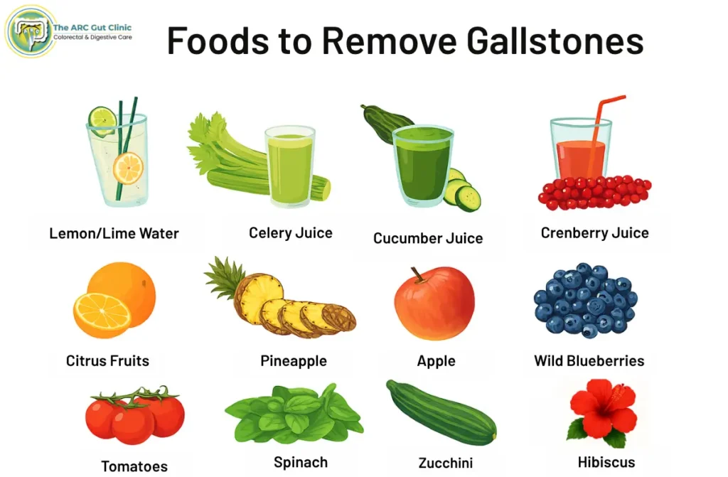 How to Get rid of Gallstones