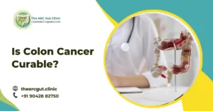Is Colon Cancer Curable?