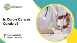 Is Colon Cancer Curable?