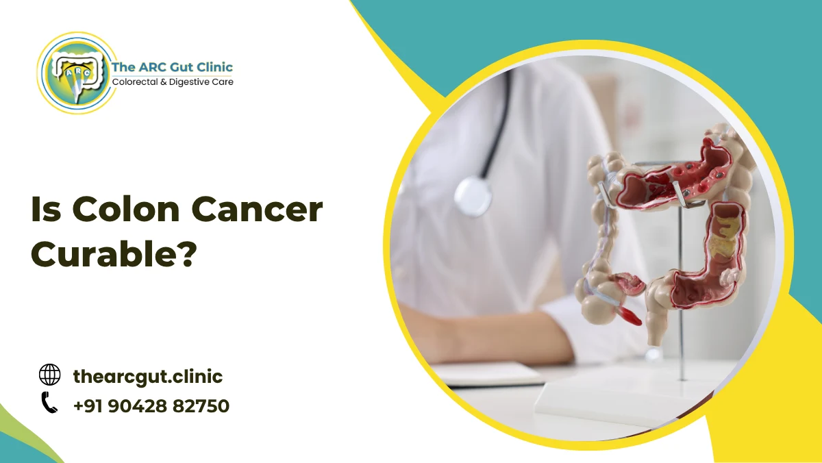 Is Colon Cancer Curable?