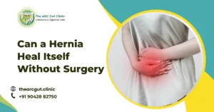Can a Hernia Heal Itself Without Surgery