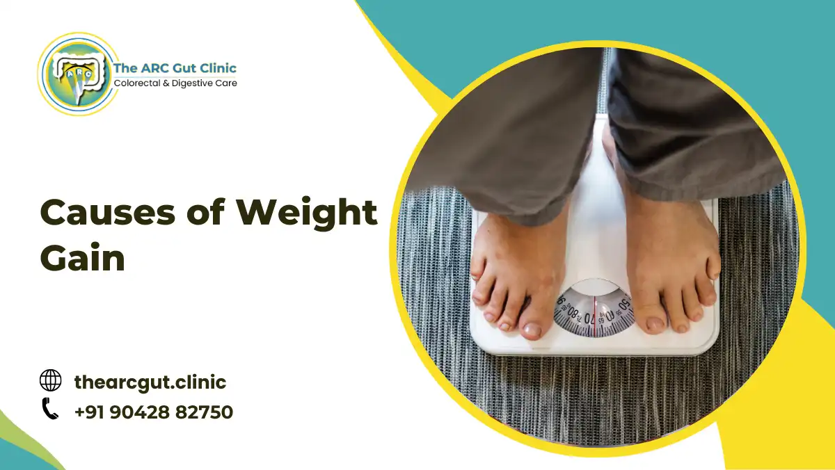 Causes of Weight Gain