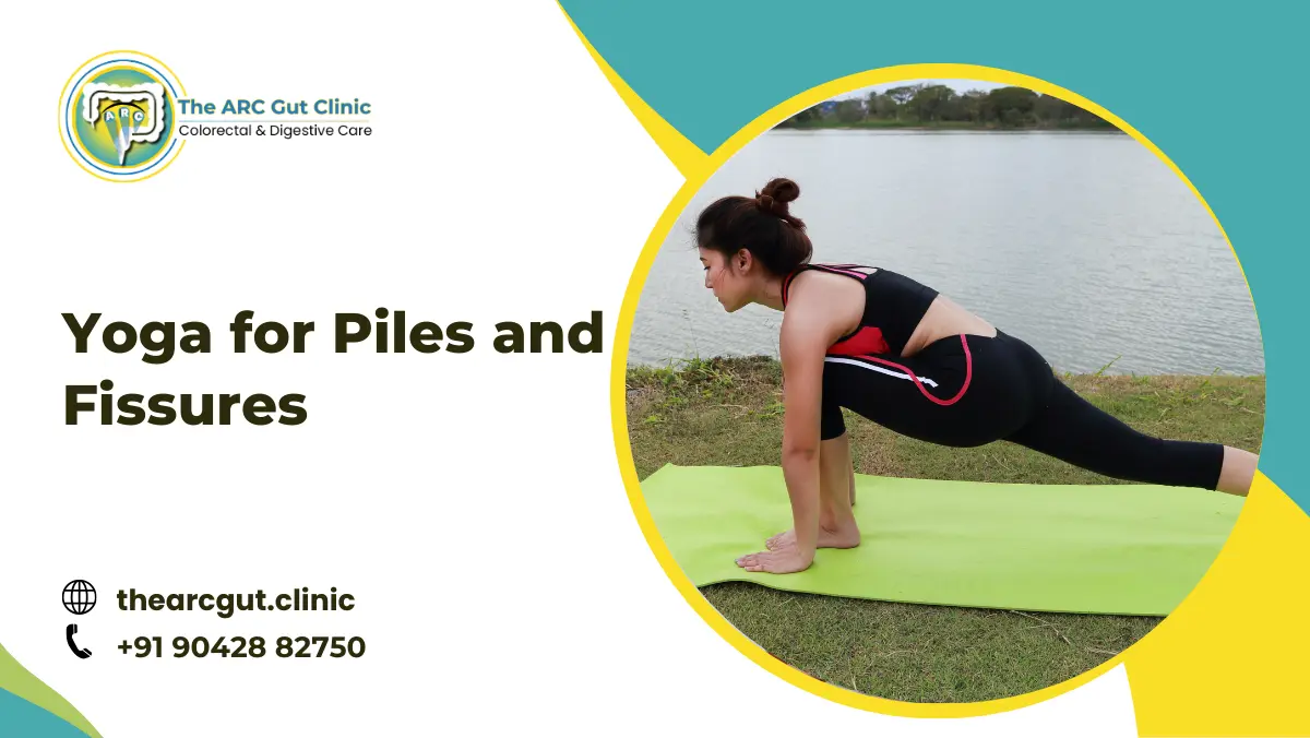 Yoga for Piles and Fissures