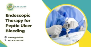 Endoscopic Therapy for Peptic Ulcer Bleeding