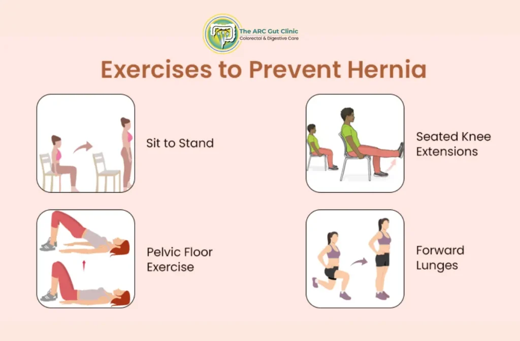 Hernia Exercises to Avoid