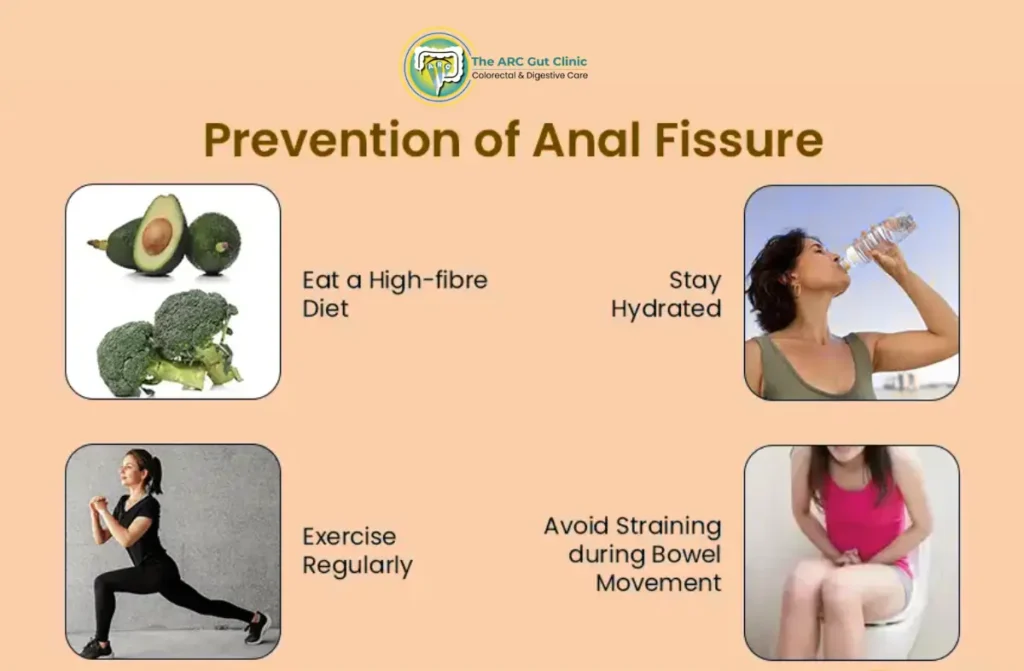 How to Cure Fissure Permanently