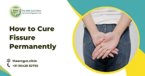 How to Cure Fissure Permanently