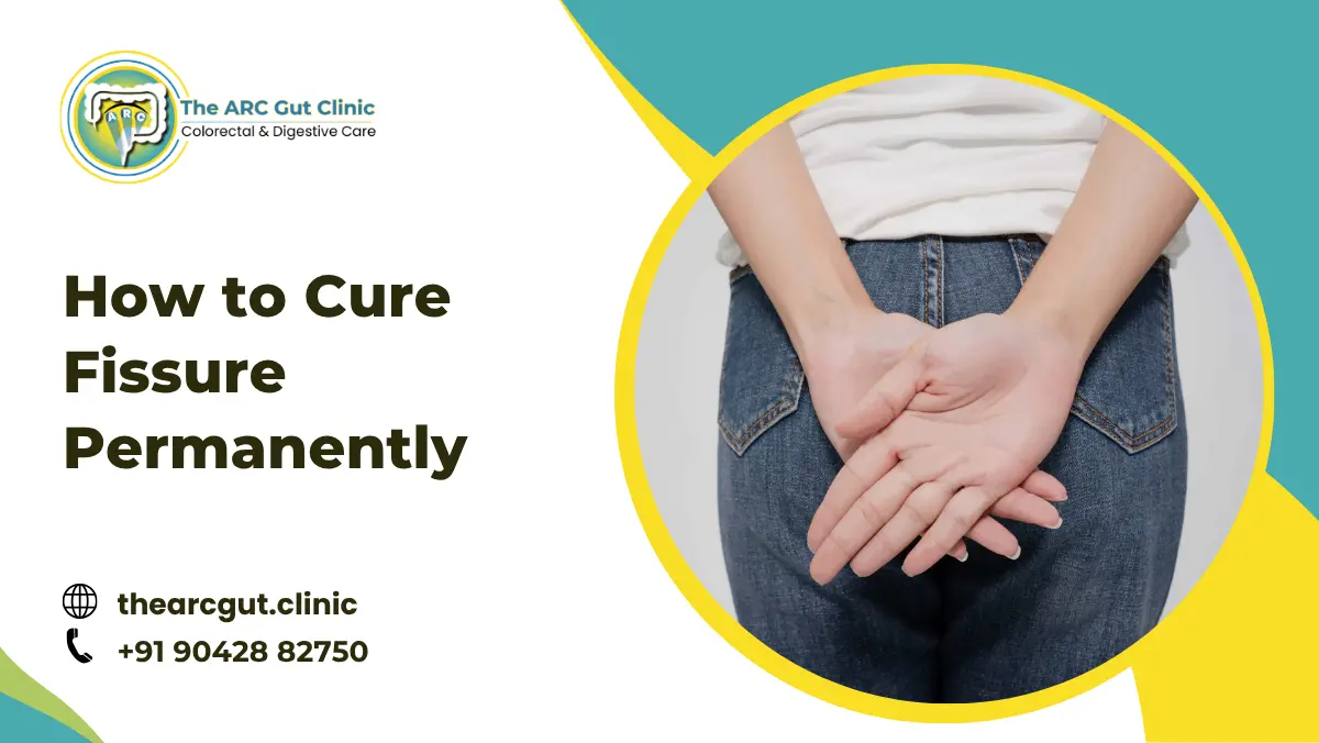 How to Cure Fissure Permanently