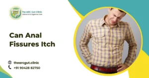 Can Anal Fissures Itch